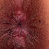 Thumbnail of related posts 157
